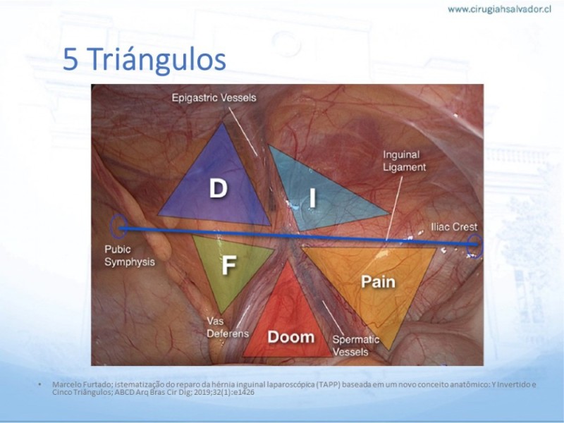 Diapositiva 14 de Hernia Inguinal: Hitos Anatómicos para cirugía laparoscópica-3
