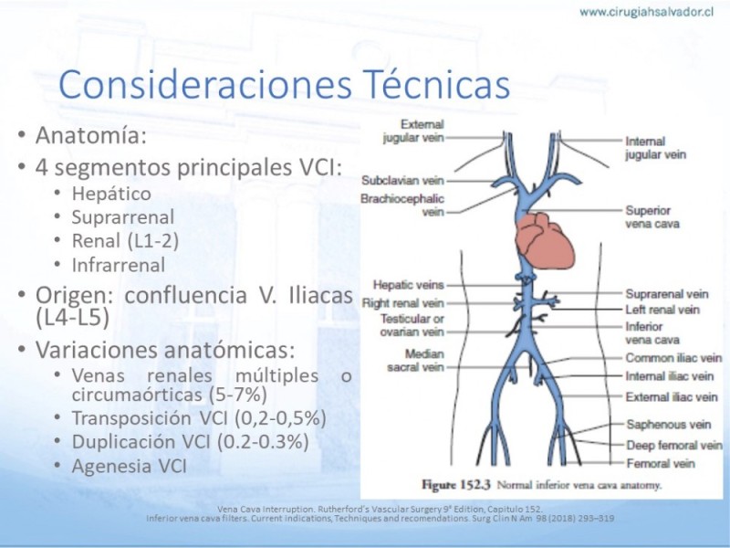 Diapositiva 17 de Indicaciones de Filtro de Vena Cava
