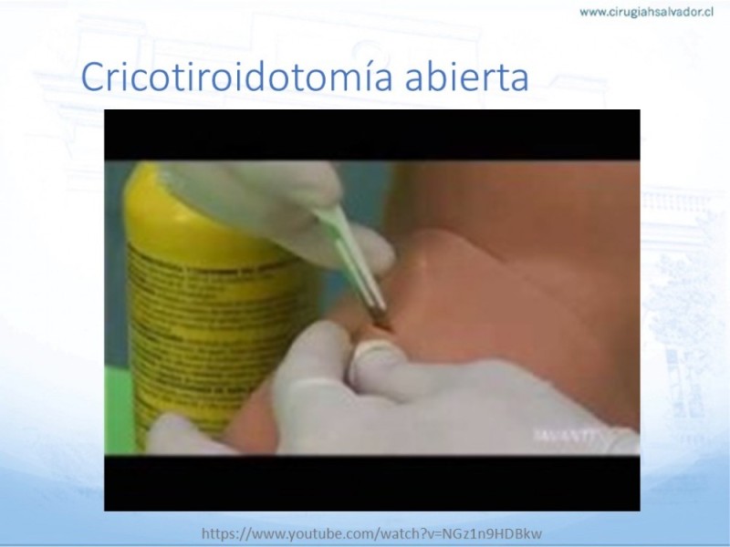 Diapositiva 33 de Manejo de Vía Aérea. Evaluación, Dispositivos y Algoritmos DAS
