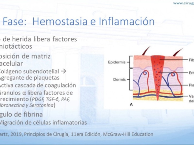 Diapositiva 2 de Cicatrización normal y patológica