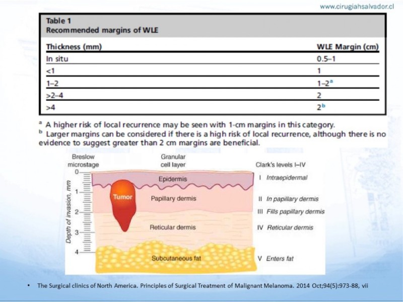 Diapositiva 9 de Manejo Quirúrgico del Melanoma
