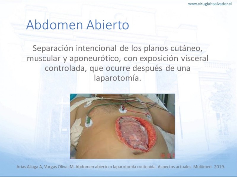 Diapositiva 19 de Caso Clínico