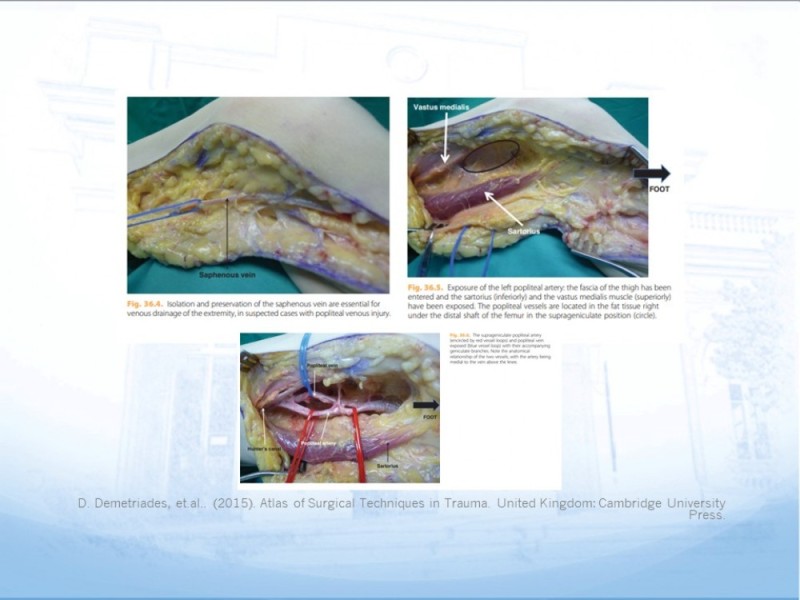 Diapositiva 25 de Control de lesión vascular para el cirujano general