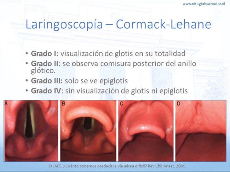 Diapositiva 22 de Manejo de Vía Aérea. Evaluación, Dispositivos y Algoritmos DAS