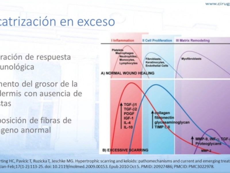 Diapositiva 14 de Cicatrización normal y patológica