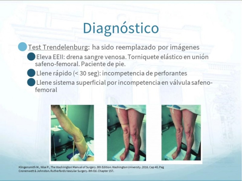 Diapositiva 11 de Insuficiencia Venosa Crónica