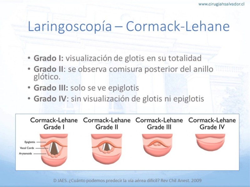 Diapositiva 21 de Manejo de Vía Aérea. Evaluación, Dispositivos y Algoritmos DAS