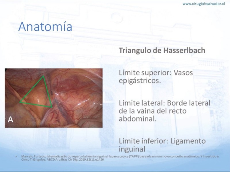Diapositiva 6 de Hernia Inguinal: Hitos Anatómicos para cirugía laparoscópica-3