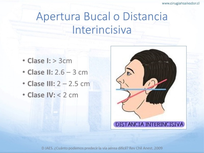 Diapositiva 9 de Manejo de Vía Aérea. Evaluación, Dispositivos y Algoritmos DAS