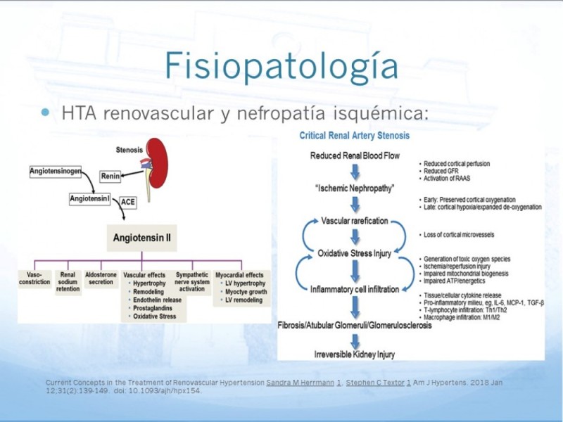 Diapositiva 6 de Enfermedad Renovascular
