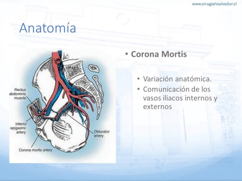 Diapositiva 9 de Hernia Inguinal: Hitos Anatómicos para cirugía laparoscópica-3