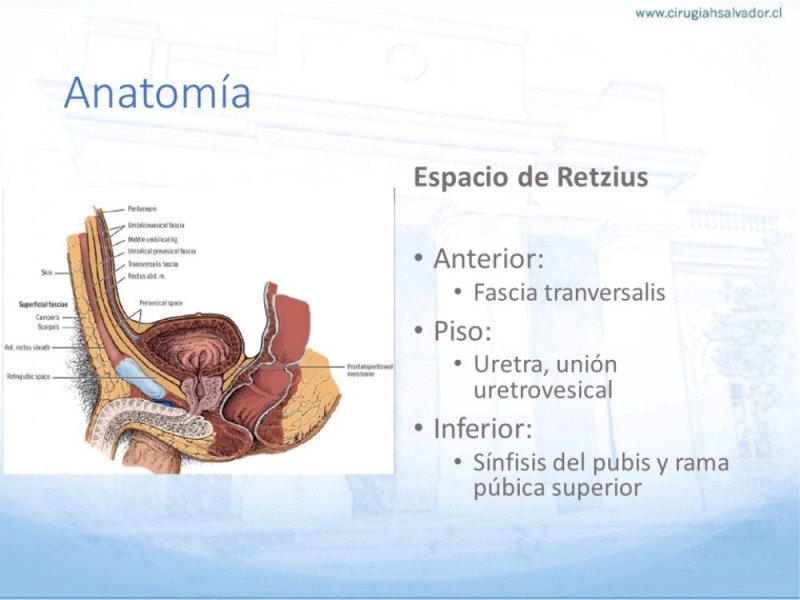 Diapositiva 7 de Hernia Inguinal: Hitos Anatómicos para cirugía laparoscópica-3