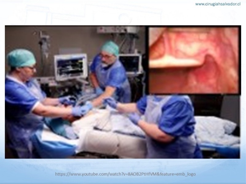 Diapositiva 23 de Manejo de Vía Aérea. Evaluación, Dispositivos y Algoritmos DAS