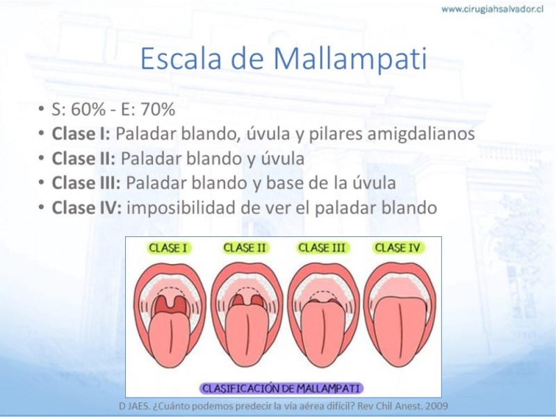 Diapositiva 10 de Manejo de Vía Aérea. Evaluación, Dispositivos y Algoritmos DAS