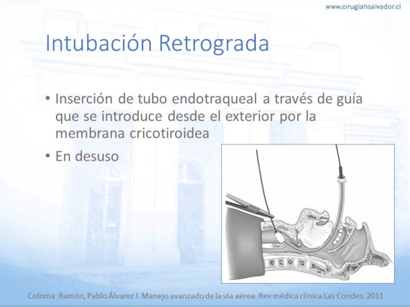Diapositiva 36 de Manejo de Vía Aérea. Evaluación, Dispositivos y Algoritmos DAS