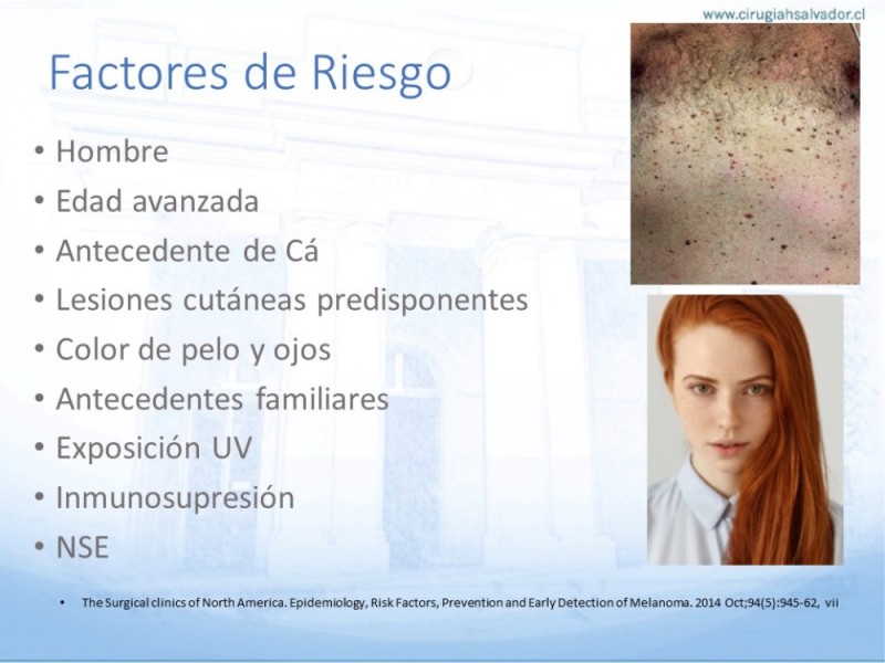 Diapositiva 3 de Manejo Quirúrgico del Melanoma