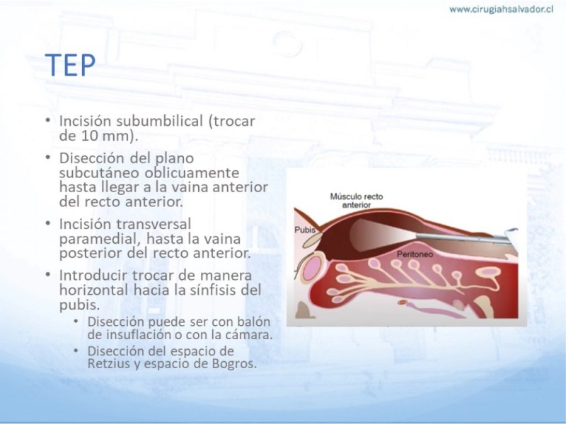 Diapositiva 28 de Hernia Inguinal: Hitos Anatómicos para cirugía laparoscópica-3
