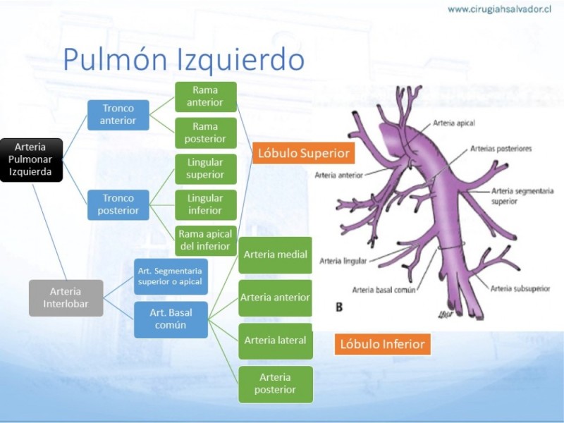 Diapositiva 11 de Anatomía Quirúrgica: Pulmón y Bronquios
