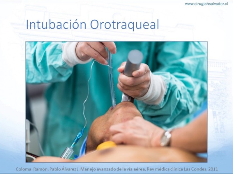 Diapositiva 20 de Manejo de Vía Aérea. Evaluación, Dispositivos y Algoritmos DAS