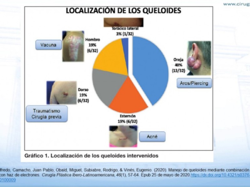 Diapositiva 18 de Cicatrización normal y patológica