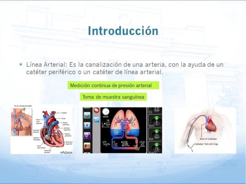 Diapositiva 3 de Tiempos de covid:instalación y retiro de vías arteriales