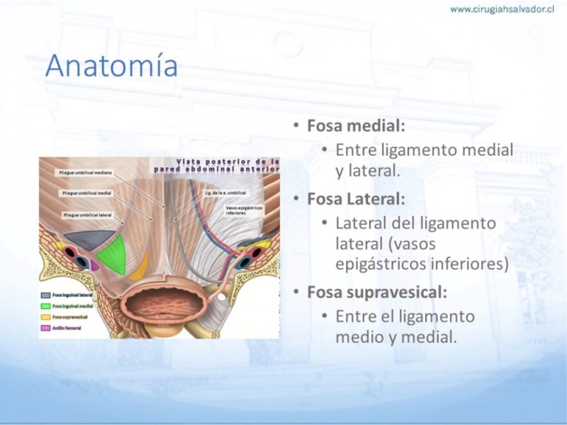 Diapositiva 5 de Hernia Inguinal: Hitos Anatómicos para cirugía laparoscópica-3