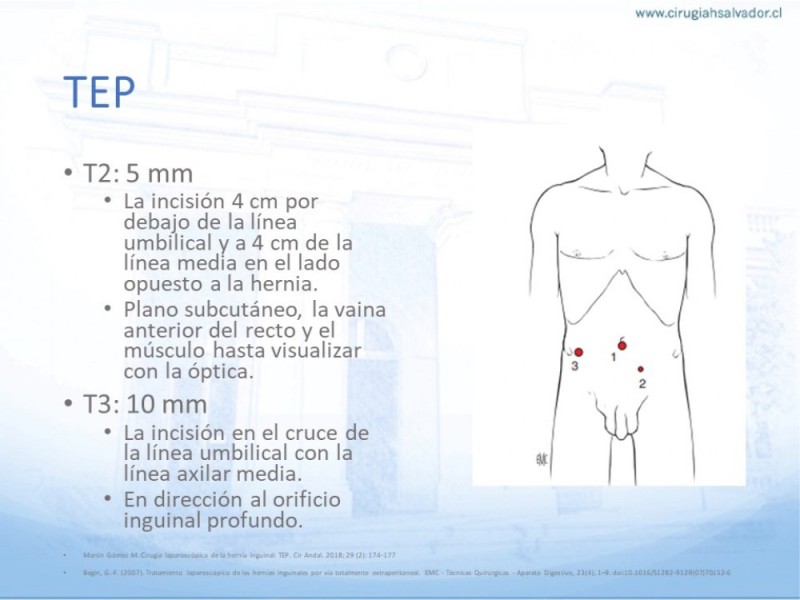 Diapositiva 29 de Hernia Inguinal: Hitos Anatómicos para cirugía laparoscópica-3