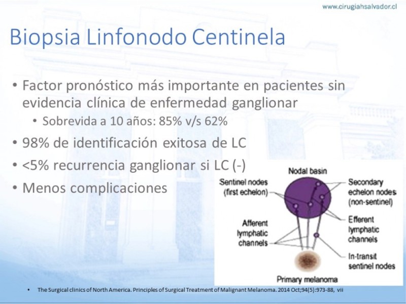 Diapositiva 12 de Manejo Quirúrgico del Melanoma
