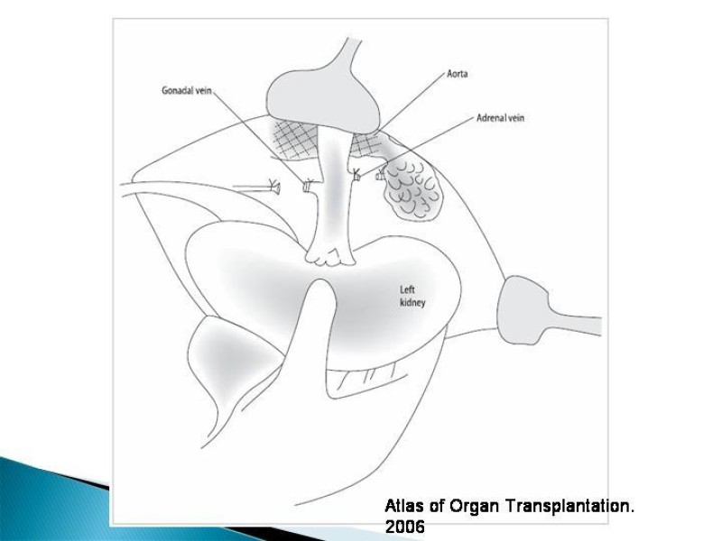 Diapositiva 47 de Técnica de procuramiento renal