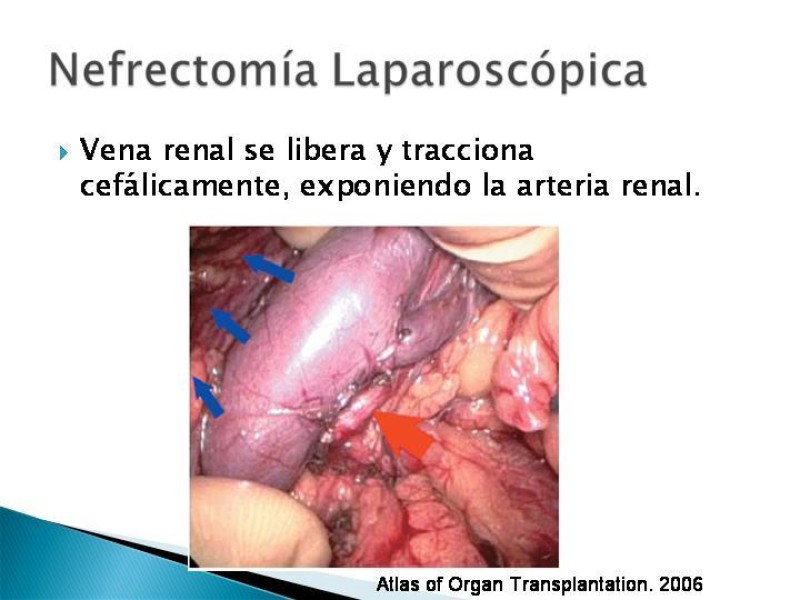 Diapositiva 71 de Técnica de procuramiento renal