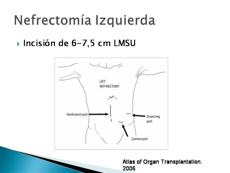 Diapositiva 55 de Técnica de procuramiento renal