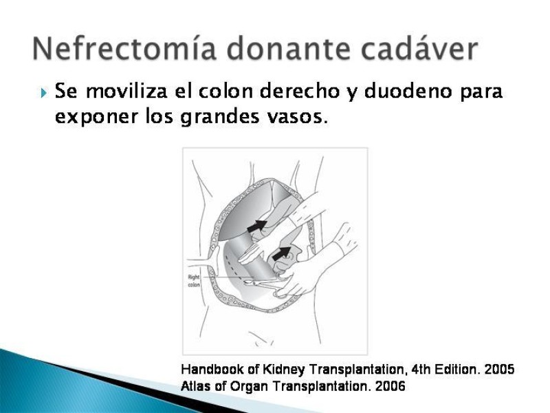 Diapositiva 27 de Técnica de procuramiento renal