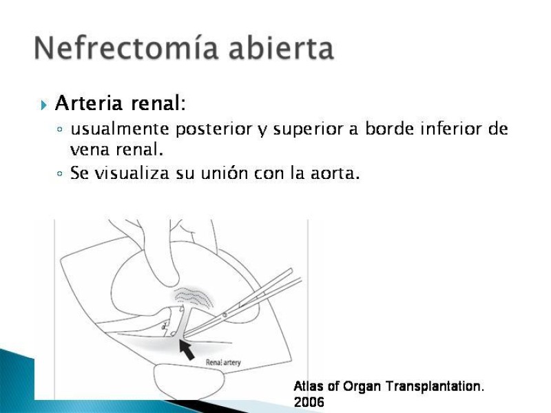 Diapositiva 48 de Técnica de procuramiento renal