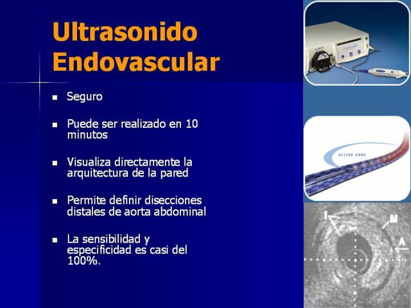 Diapositiva 26 de Disección Aórtica