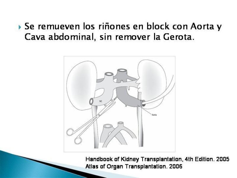 Diapositiva 32 de Técnica de procuramiento renal
