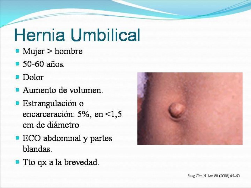 Diapositiva 3 de Hernia Umbilical, Epigástrica y Spieguel