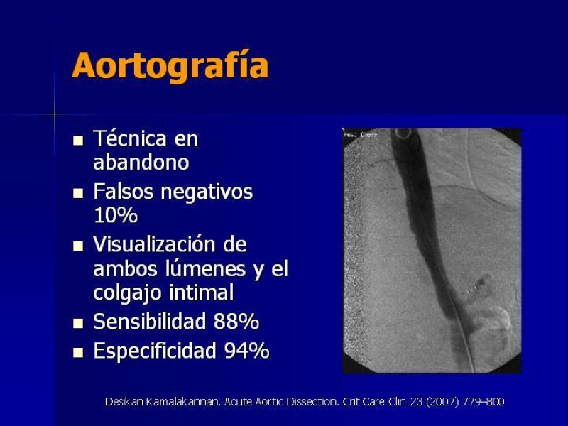 Diapositiva 17 de Disección Aórtica