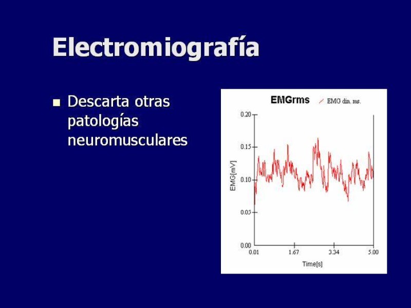 Diapositiva 17 de Síndrome del Opérculo Torácico