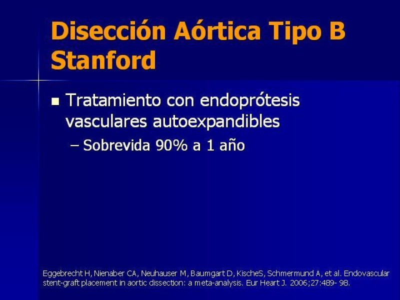 Diapositiva 35 de Disección Aórtica