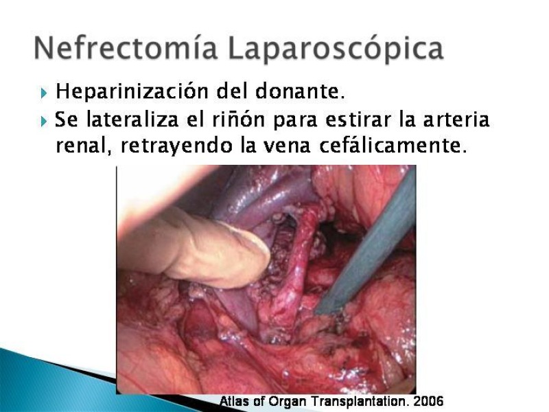Diapositiva 78 de Técnica de procuramiento renal
