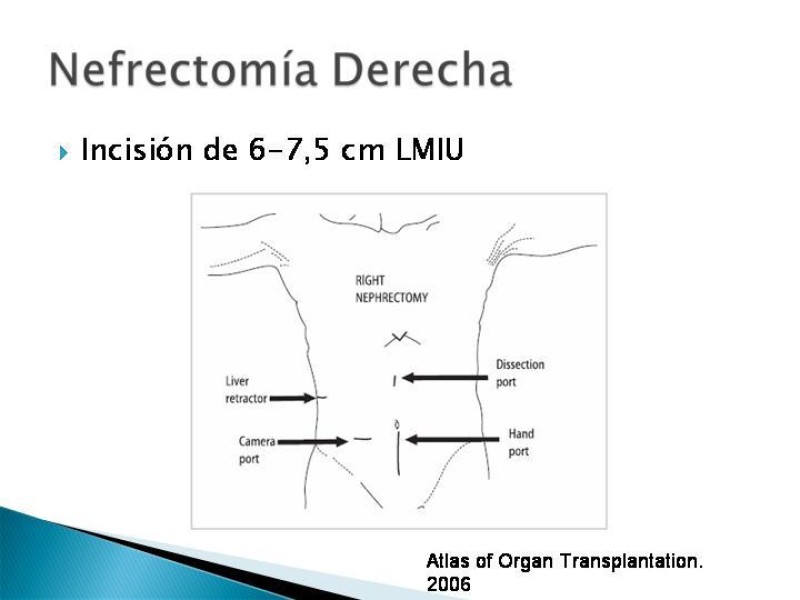 Diapositiva 57 de Técnica de procuramiento renal