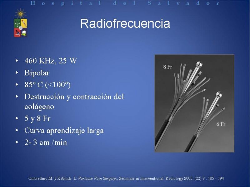 Diapositiva 16 de Ablación de várices en EEII
