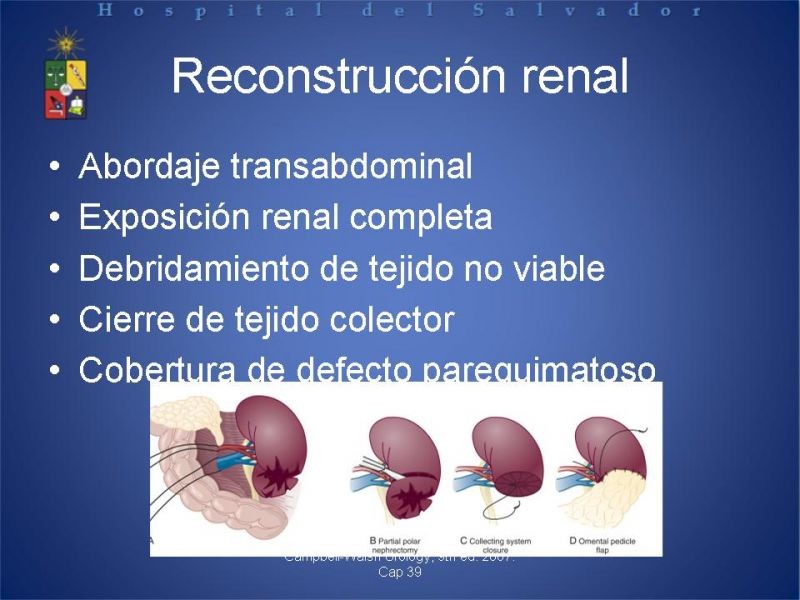 Diapositiva 16 de Trauma Renal