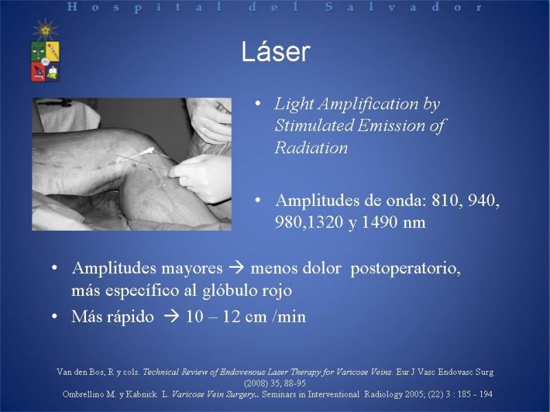 Diapositiva 14 de Ablación de várices en EEII