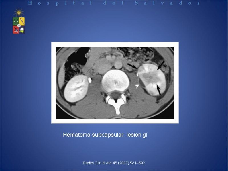 Diapositiva 8 de Trauma Renal