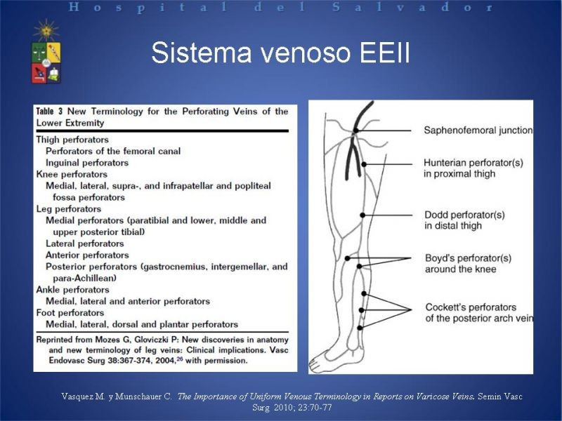 Diapositiva 6 de Ablación de várices en EEII