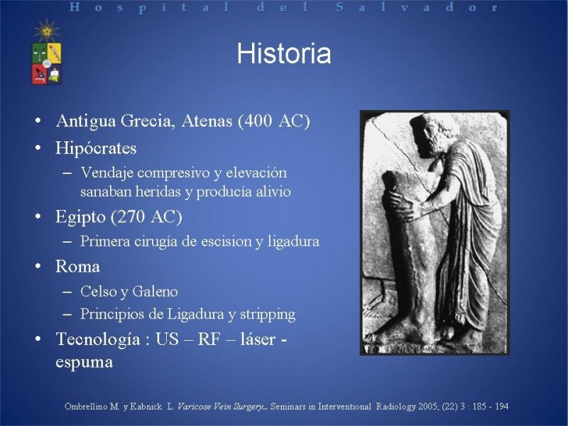 Diapositiva 2 de Ablación de várices en EEII