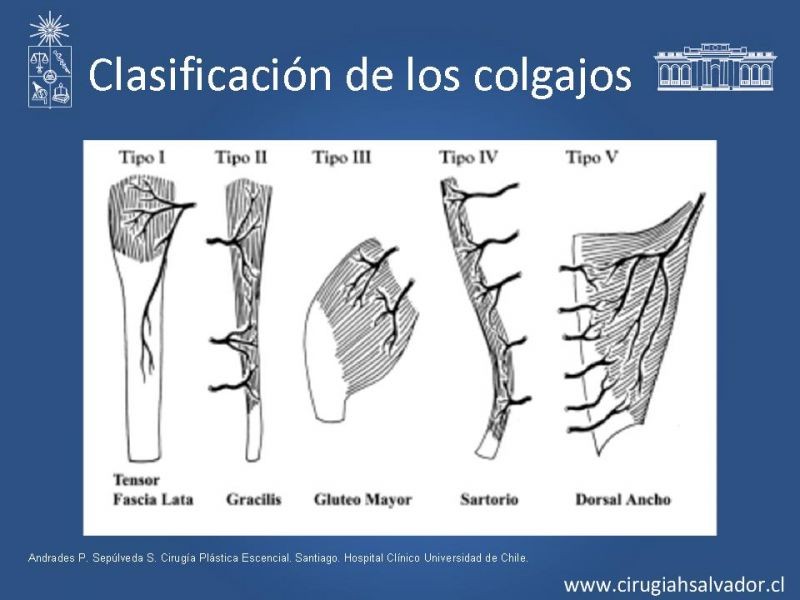Diapositiva 21 de Colgajos