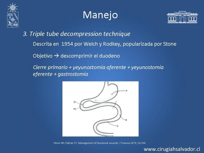 Diapositiva 25 de Nódulo Tiroideo