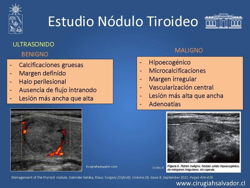 Diapositiva 8 de Nódulo Tiroideo
